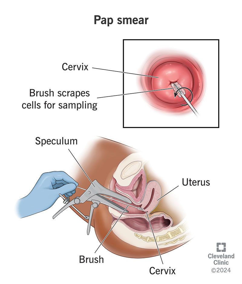 What to Expect During a Pap Smear Test